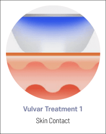 eleVAVA vulvar treatment step 1: skin contact