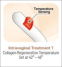 eleVAVA intravaginal treatment step 1: temperature set at 42–46°C